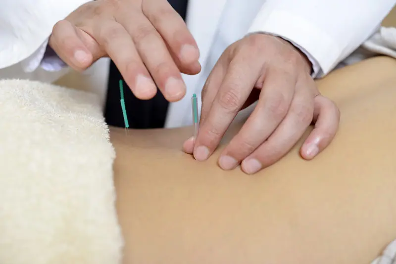 鍼灸(はり・お灸)