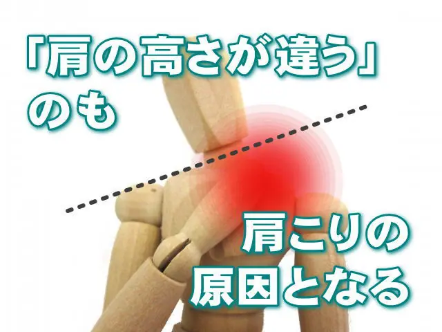 「肩の高さが違う」のも肩こりの原因となる